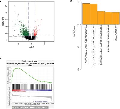 Altered extracellular matrix correlates with an immunosuppressive tumor microenvironment and disease progression in younger adults with oral cavity squamous cell carcinoma